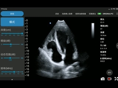 3.6MHz 가지고 다닐 수 있는 무선 전신 초음파 프로브 페이즈드 어레이 트랜스듀서