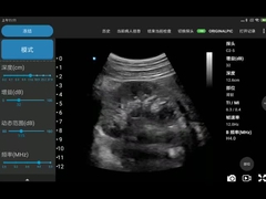 CE는 3.6MHz 가지고 다닐 수 있는 와이파이 초음파 스캐너 JPEG BMP PNG MPEG-4를 표시했습니다