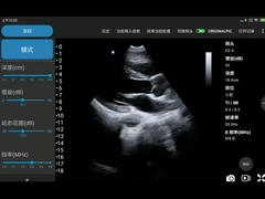 모바일 심장 진단을 위한 5MHz 주머니 포켓용 초음파 스캐너