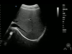 ISO13485 휴대용 의료 기기는 탐침 포켓용 건강 스캐너를 볼록하게 합니다