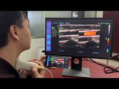 스마트폰/PC에 사용되는 iTrason USB 선형 초음파 프로브