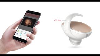Marvoto 태아 카메라 M1- 3D 휴대용 초음파