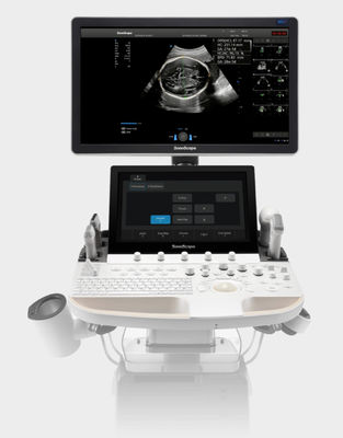 주문 인공지능 기반을 둔 소노스케이프 초음파 기계 손수레 P60 경험 online manufacture