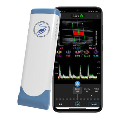 주문 iPhone 및 iPad용 12MHz 무선 휴대용 초음파 스캐너 | 전자 선형 어레이 컬러 도플러 프로브 online manufacture