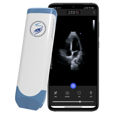 주문 POCUS 심장 초음파 검사를 위한 무선 단계 배열 소형 초음파 스캐너 5MHz 소형 심장 초음파 online manufacture