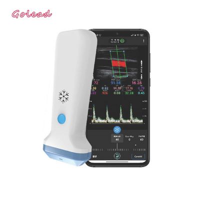 주문 아이폰을 위한 12MHz 3000mAh 무선 탐침 형태 초음파 스캐너 online manufacture