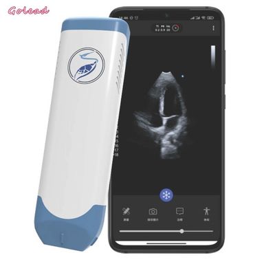 주문 3.6MHz 가지고 다닐 수 있는 무선 전신 초음파 프로브 페이즈드 어레이 트랜스듀서 online manufacture