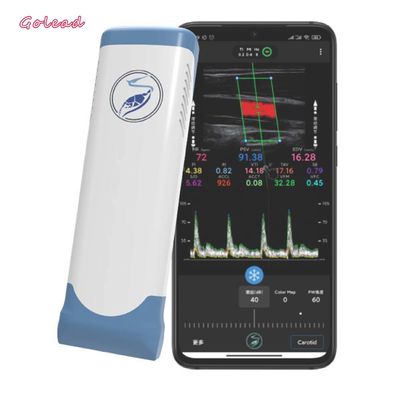 주문 전자적 직선 어레이 와이파이 무선 전신 휴대용 초음파 스캐너 12MHz online manufacture