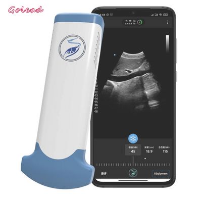 주문 휴대폰을 위한 전자적 컨벡스 어레이 무선 초음파 장치 online manufacture