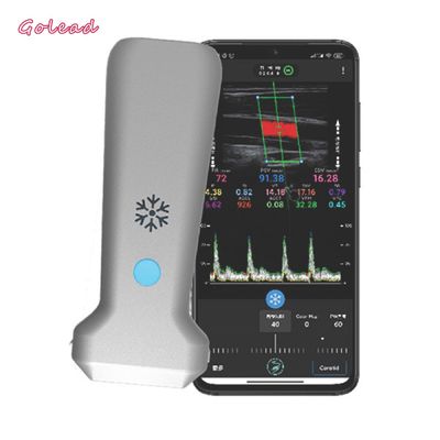 주문 126 밀리미터는 관 MSK 신경을 위한 탐침 초음파 스캐너를 볼록하게 합니다 online manufacture