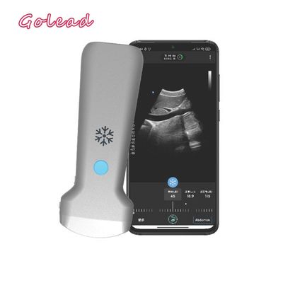 주문 CE는 안드로이드에 대해 전자적 컨벡스 어레이 USG 심장 탐침 초음파를 승인했습니다 online manufacture