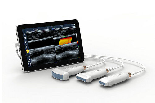 주문 USB Type-C 선형 휴대용 초음파 스캐너 10MHz 혈관 및 POCUS용 휴대용 안드로이드 초음파 프로브 online manufacture