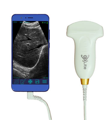 주문 전자적 컨벡스 어레이 컬러 도플러 포켓용 초음파 스캐너 3.5MHz online manufacture