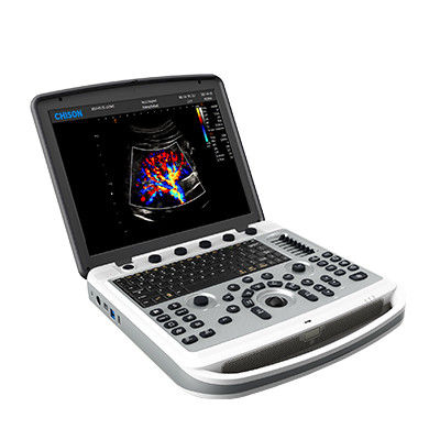 주문 120' 회전 가능한 치슨 소노북 6 휴대용 노트북 초음파 기계 online manufacture