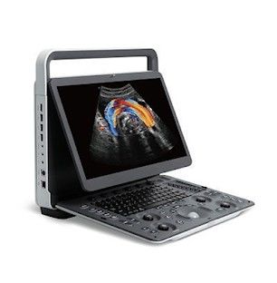 주문 개관적 이미지화 소노스케이프 E2 프로 휴대용 초음파 기계 online manufacture