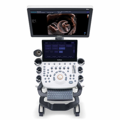 주문 OB와 부인과의학을 위한 4D 엘라스토그라피 소노스케이프 초음파 기계 online manufacture
