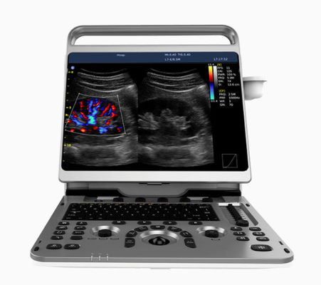주문 가지고 다닐 수 있는 심장 초음파 기계 치슨 법인세차감전의 순이익 50 16.5lbs online manufacture
