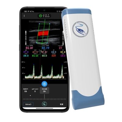 주문 반향 컬러 도플러 무선 휴대장치 초음파 스캐너 100 프레임 online manufacture