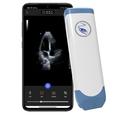 주문 아이폰 3.6MHz를 위한 깊이 18.9 센티미터 포켓용 초음파 스캐너 online manufacture