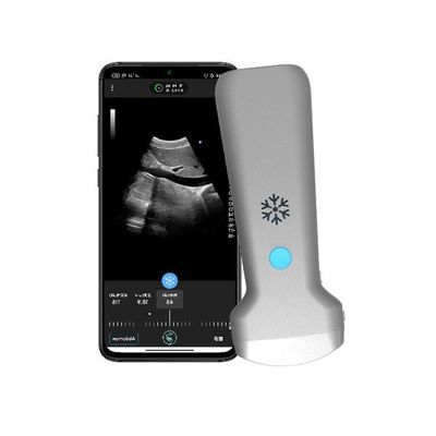 주문 ISO13485 무선 볼록형 휴대용 초음파 스캐너 | 휴대용 컬러 도플러 초음파 프로브 online manufacture