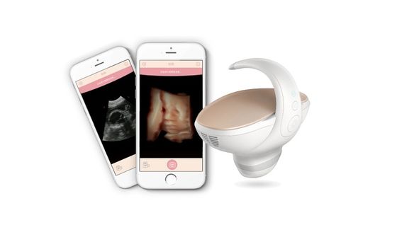 주문 CE 승인 3D/4D 휴대용 태아 초음파 스캐너
포터블 임신 영상 솔루션과 60° 광각 웅덩이 탐사 online manufacture