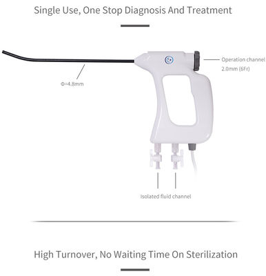주문 부인과 내시경 절차를 위한 FDA CE ISO13485 일회용 전자 자궁경 4.8mm online manufacture
