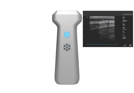 주문 선형 검색법 무선 전신 휴대용 초음파 기계 32 채널 online manufacture