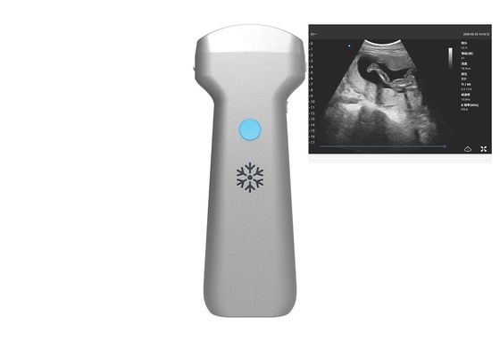 주문 전자적 컨벡스 어레이 볼록한 무선 전신 초음파 프로브 2MHz 3.6MHz 5MHz online manufacture