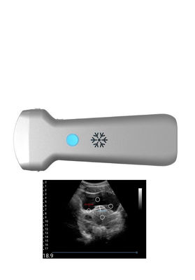 주문 부인과의학을 위한 초음파처리 볼록한 무선 전신 초음파 프로브 online manufacture
