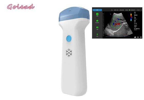 주문 POCUS 시험 일차 진료를 위한 마취 아이패드 무선 전신 초음파 프로브 online manufacture
