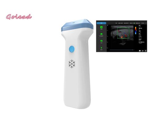 주문 안드로이드 3000mAh를 위한 고리드 PWD 방식 무선 전신 초음파 프로브 online manufacture