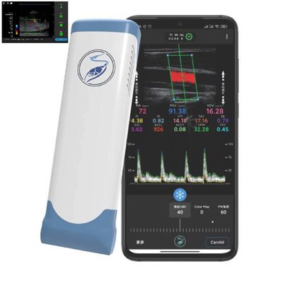 주문 PICC를 위한 256개의 스캔 라인 아이패드 초음파 트랜스듀서 무선 초음파 프로브 online manufacture
