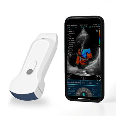 주문 POCUS 임상 진단을 위한 휴대용 아이패드 소형 초음파 스캐너 online manufacture
