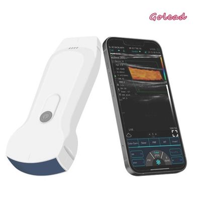 주문 12 달 보증 소형컴퓨터 초음파 스캐너 128 요소 와이파이 초음파 USG online manufacture