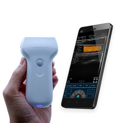 주문 CE는 병원 임상 진단을 위해 96 요소 무선 휴대용 초음파 프로브를 승인했습니다. online manufacture