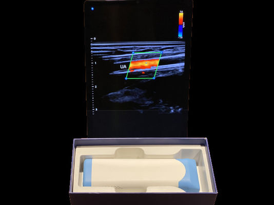 주문 첨단 휴대용 초음파 스캐너 0.2kg 3000mAh 배터리 의료용 online manufacture