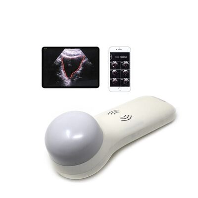 주문 현장 진료 요량 측정을 위한 무선 4D 휴대용 방광 스캐너 online manufacture