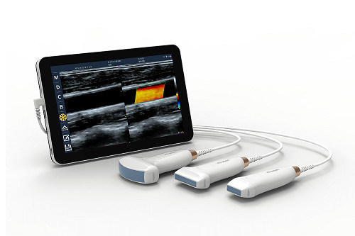 USB Type-C 선형 휴대용 초음파 스캐너 10MHz 혈관 및 POCUS용 휴대용 안드로이드 초음파 프로브