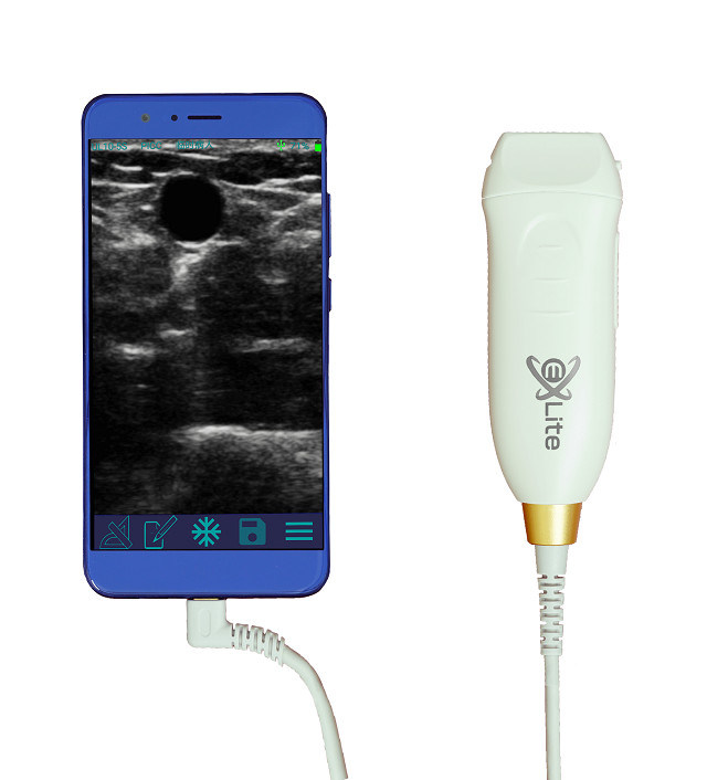 정확한 혈관 접근 및 PICC 삽입 절차를 위해 12MHZ 고 주파수 선형 탐사기와 함께 휴대용 초음파 스캐너